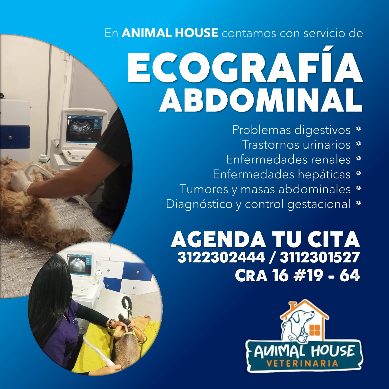 Ecografía abdominal